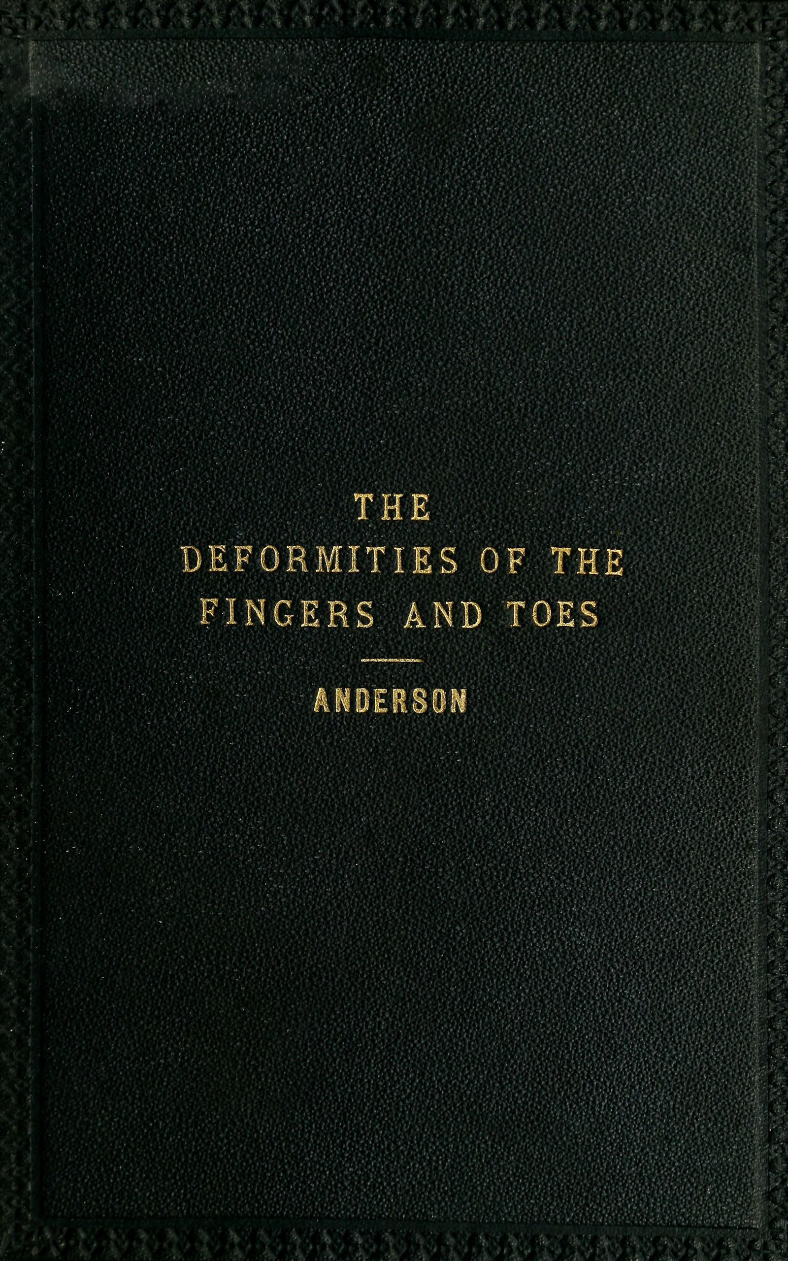 The deformities of the fingers and toes The deformities of the fingers and toes